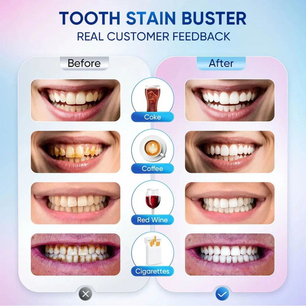 BodyAccel Niacinamide Whitening Toothpaste